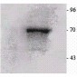 p70 S6K Antibody